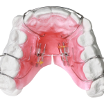 Sagittal