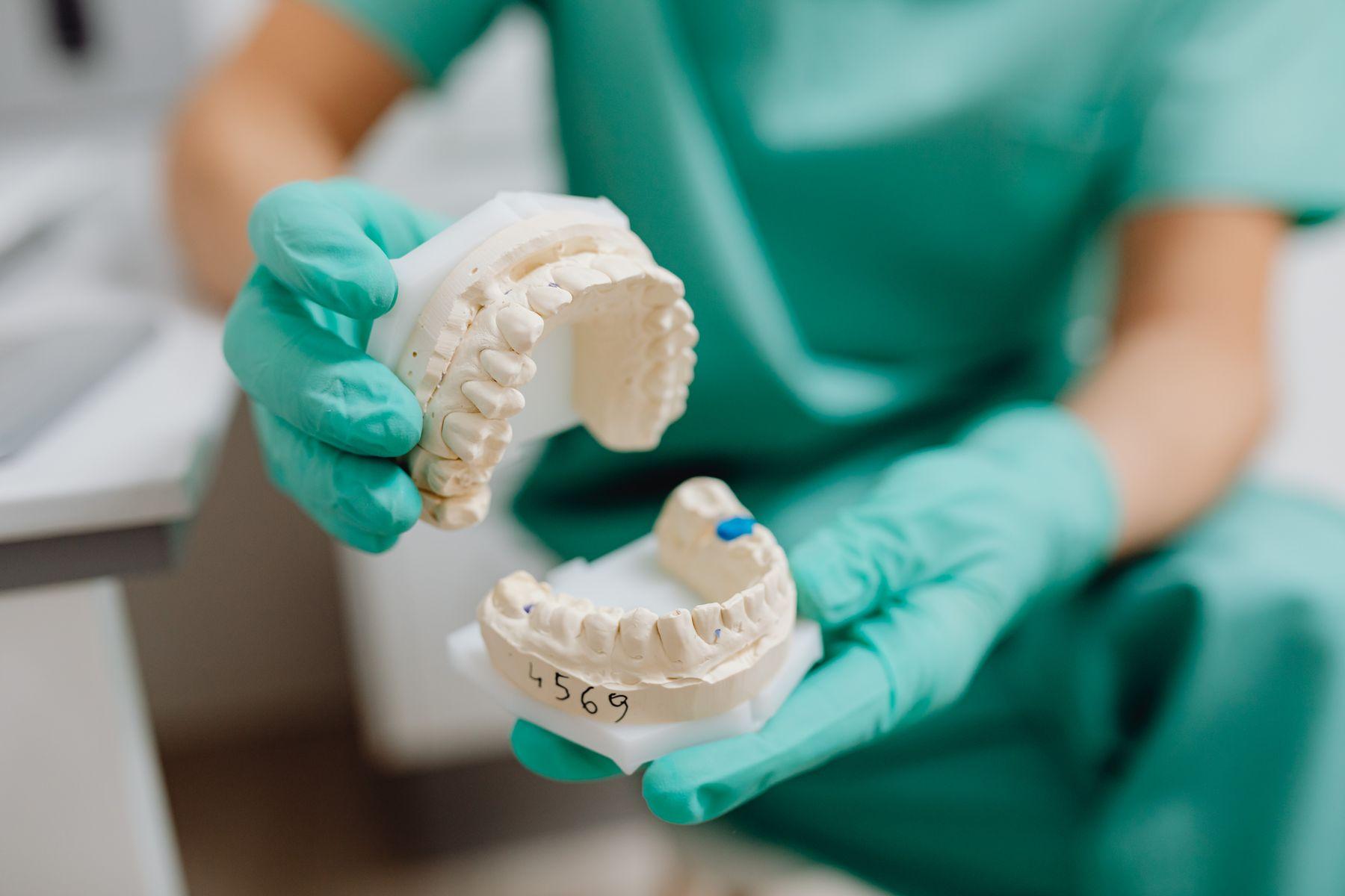 A dental cast held in gloved hands for inspection