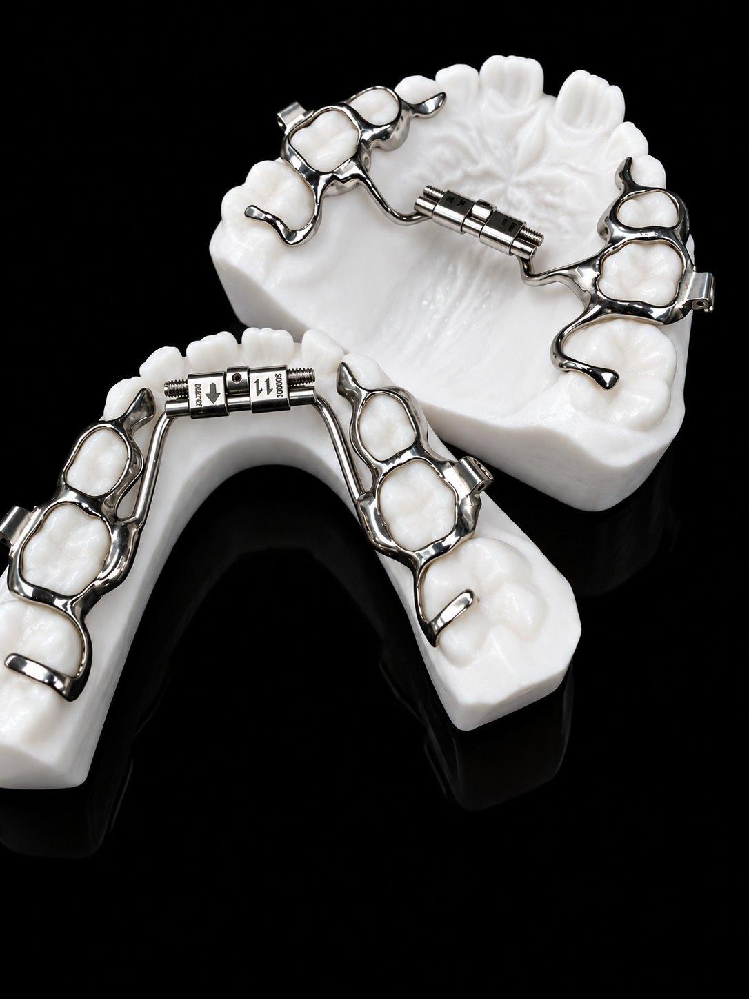 Close view of a laser sintered expander: printed bands with integral arms and a fitted expansion screw